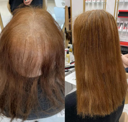 No-light cold glue hair extension Combline (Excludes hair cost)