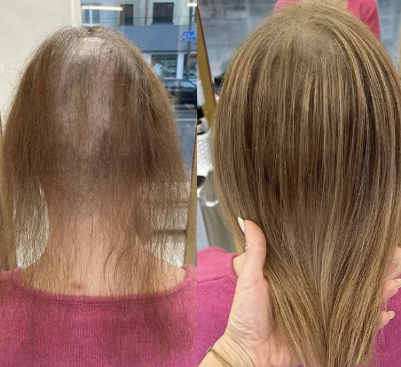 No-light cold glue hair extension Combline (Excludes hair cost)